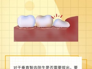 拔不拔智齿？这是一个需要慎重考虑的问题